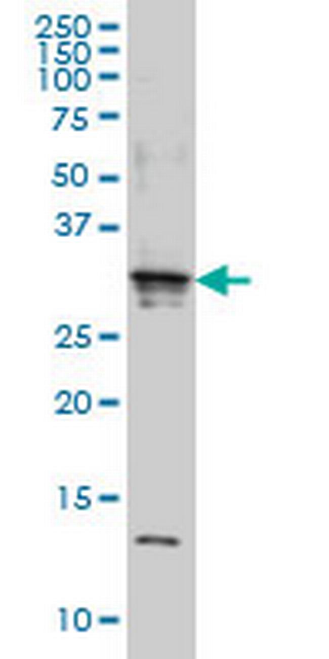 SCAND2 Antibody in Western Blot (WB)