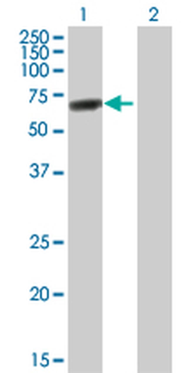 DDX56 Antibody in Western Blot (WB)