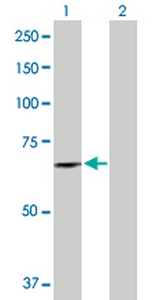 DDX56 Antibody in Western Blot (WB)