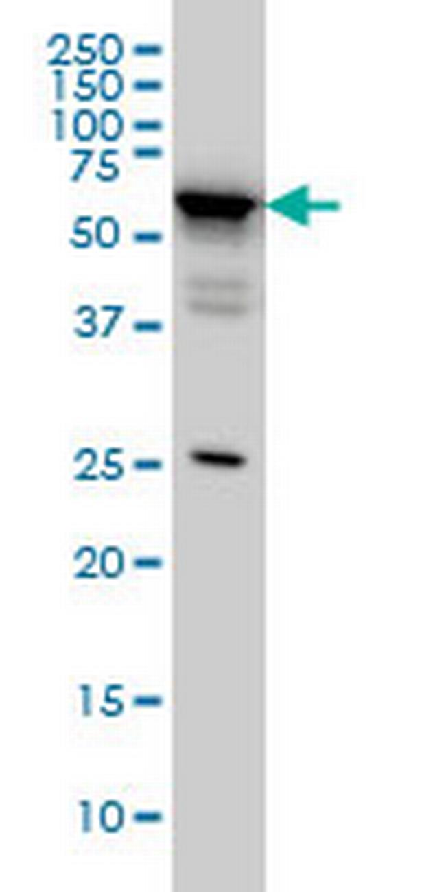 DDX56 Antibody in Western Blot (WB)