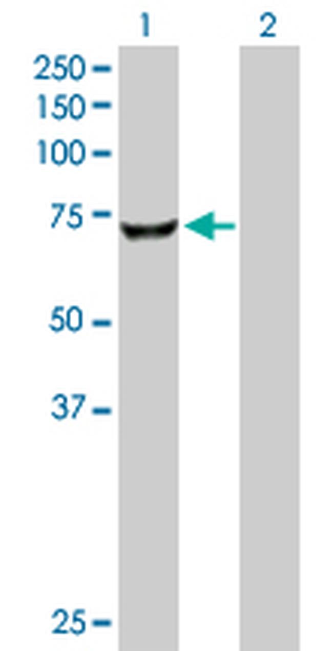 CROT Antibody in Western Blot (WB)