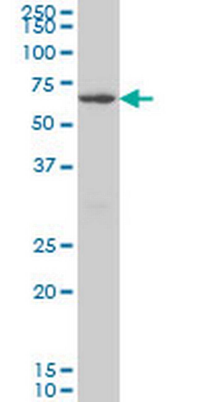CROT Antibody in Western Blot (WB)