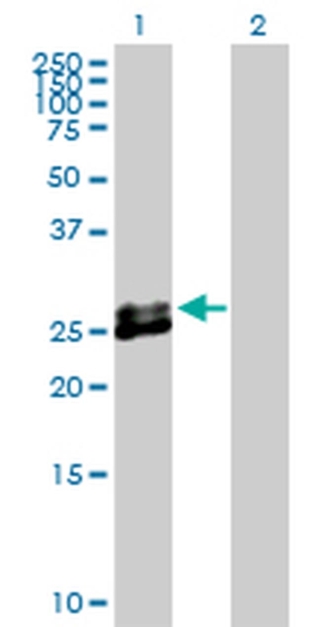 EPDR1 Antibody in Western Blot (WB)