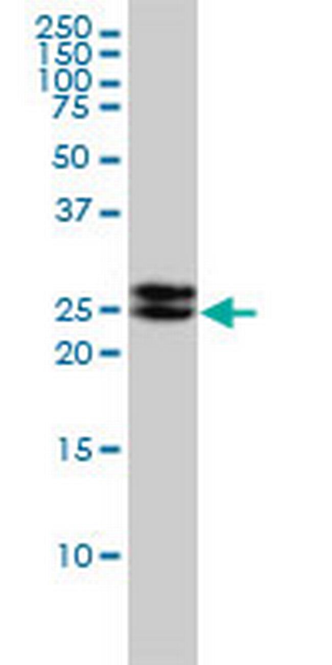 EPDR1 Antibody in Western Blot (WB)