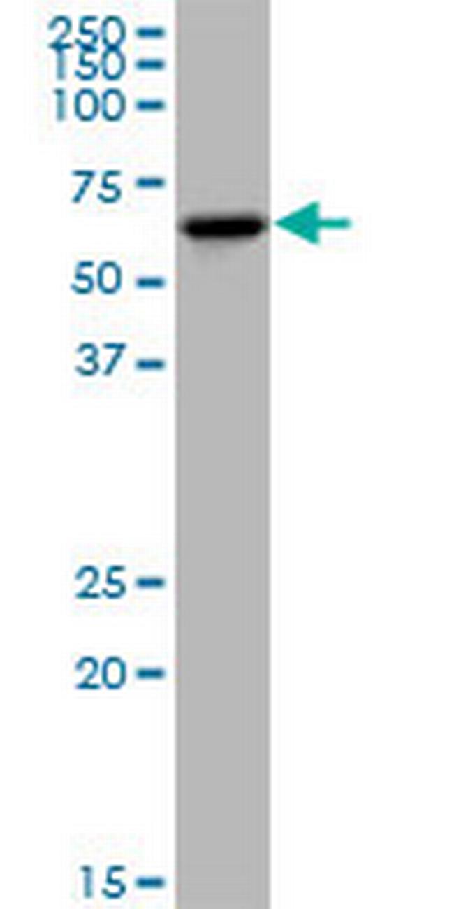 KLHDC4 Antibody in Western Blot (WB)