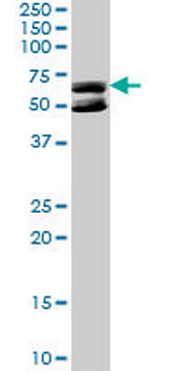 KLHDC4 Antibody in Western Blot (WB)