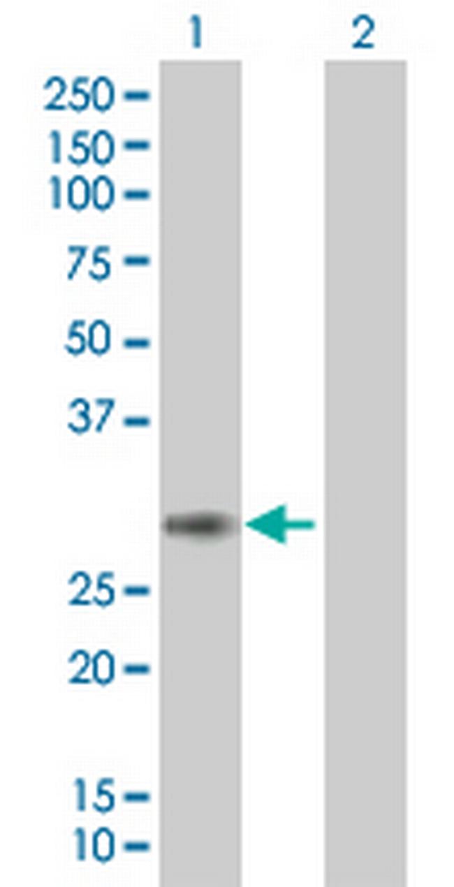 PCSK4 Antibody in Western Blot (WB)