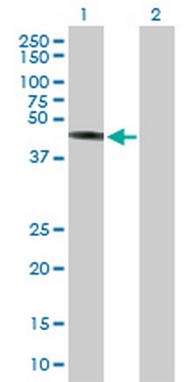 TRIM44 Antibody in Western Blot (WB)