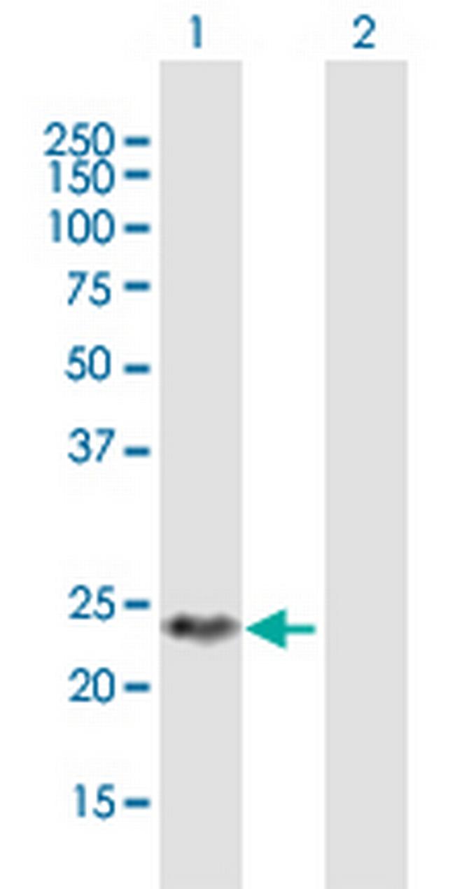 DIRAS2 Antibody in Western Blot (WB)