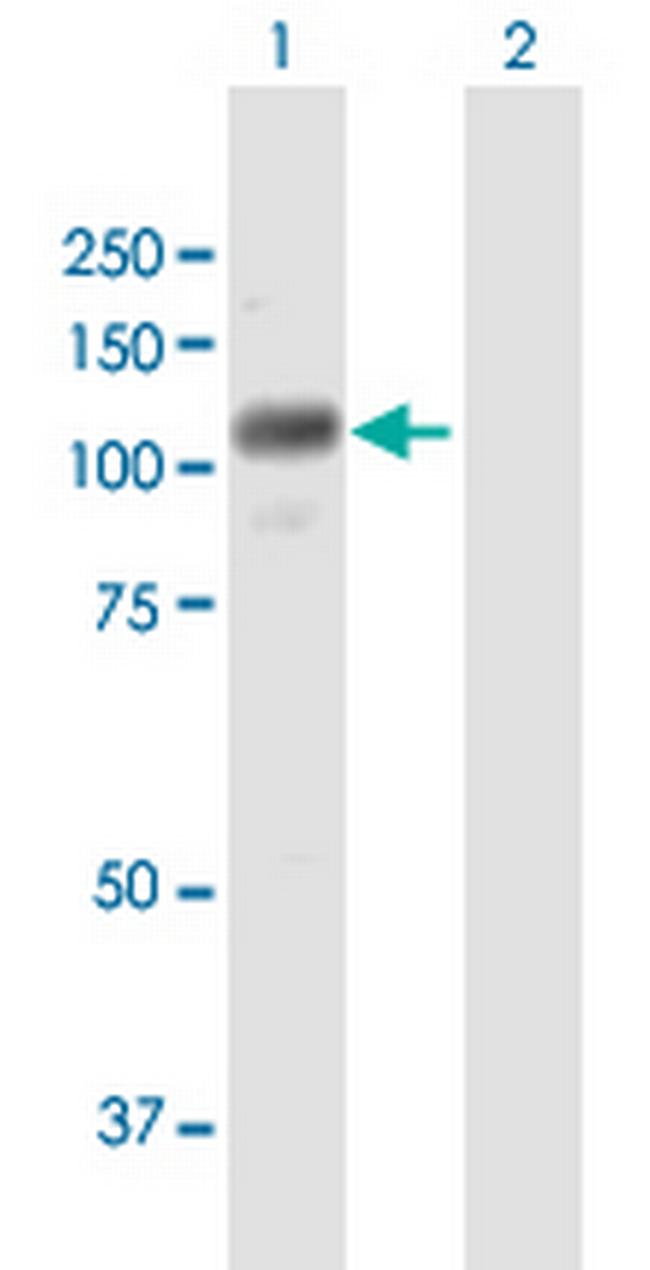 RNF111 Antibody in Western Blot (WB)