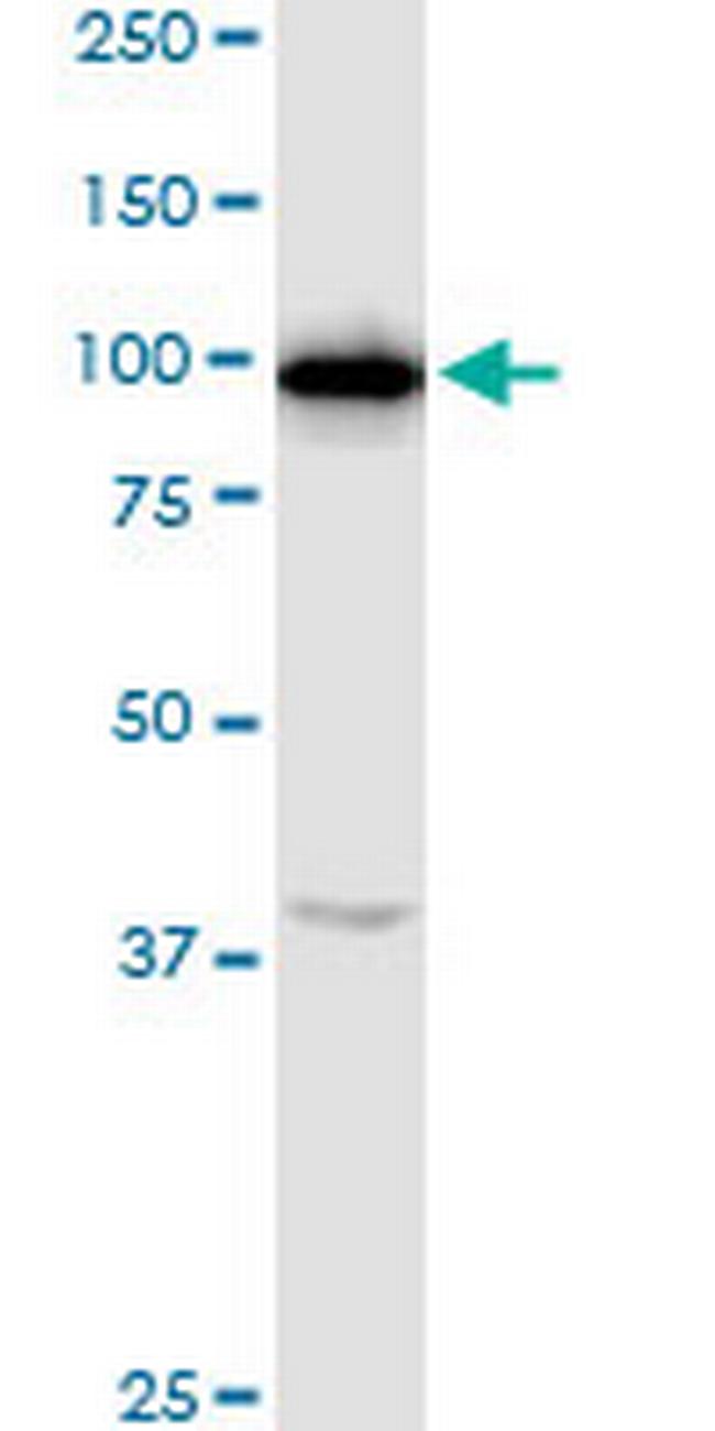 RNF111 Antibody in Western Blot (WB)