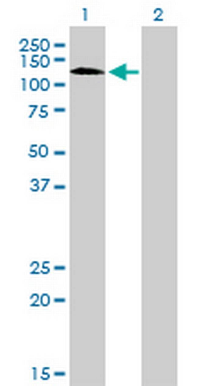 RNF111 Antibody in Western Blot (WB)