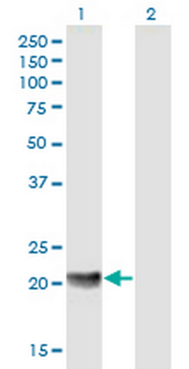 MED18 Antibody in Western Blot (WB)