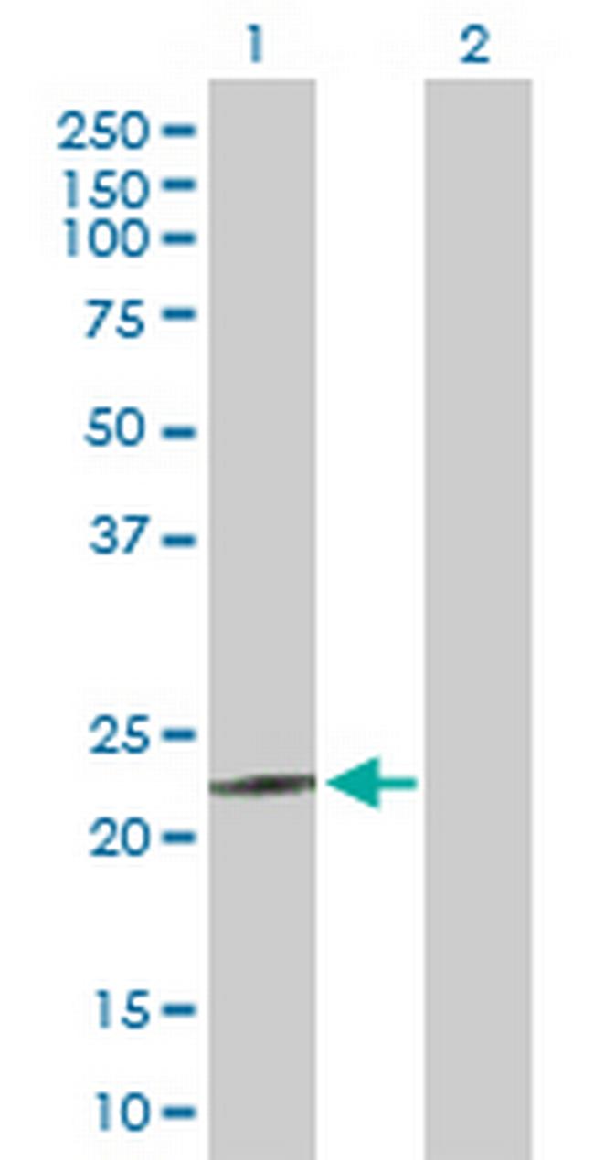 MED18 Antibody in Western Blot (WB)