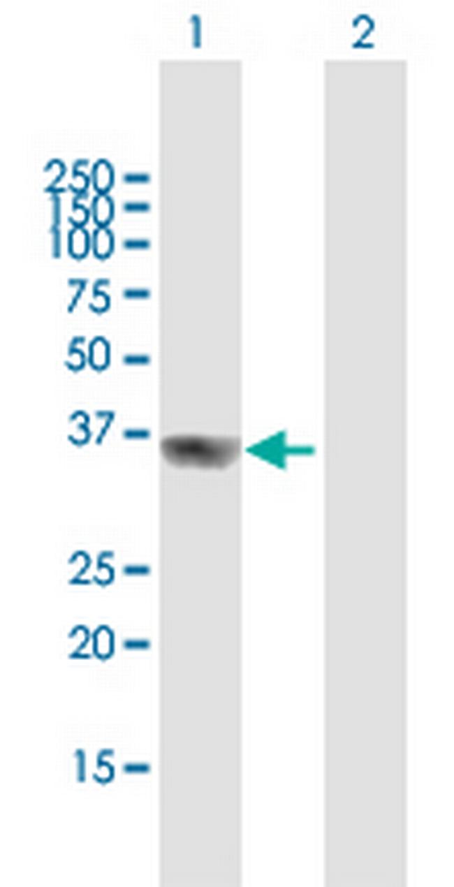 GIPC2 Antibody in Western Blot (WB)