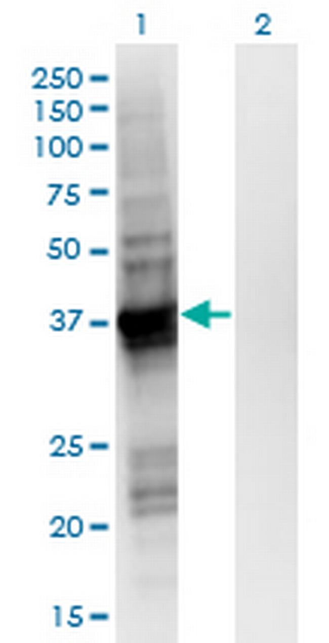 GIPC2 Antibody in Western Blot (WB)