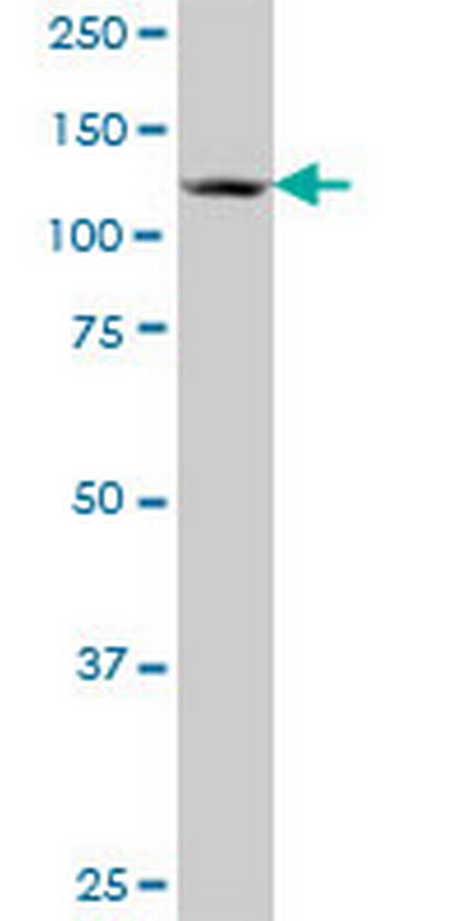 ZNF280D Antibody in Western Blot (WB)