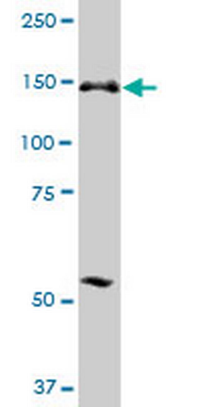 ERCC6L Antibody in Western Blot (WB)