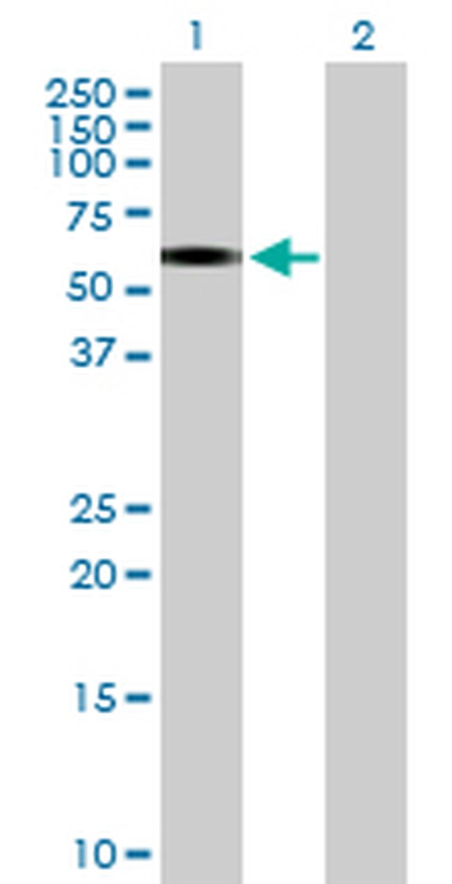 ERCC6L Antibody in Western Blot (WB)