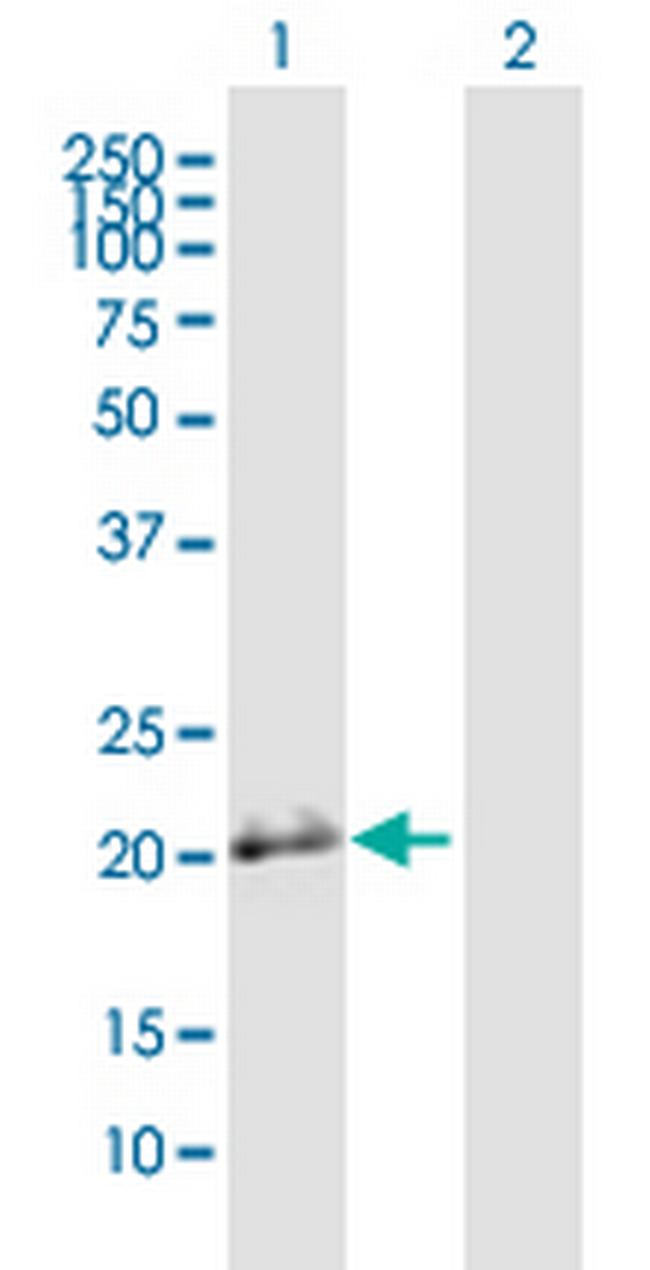 BSPRY Antibody in Western Blot (WB)