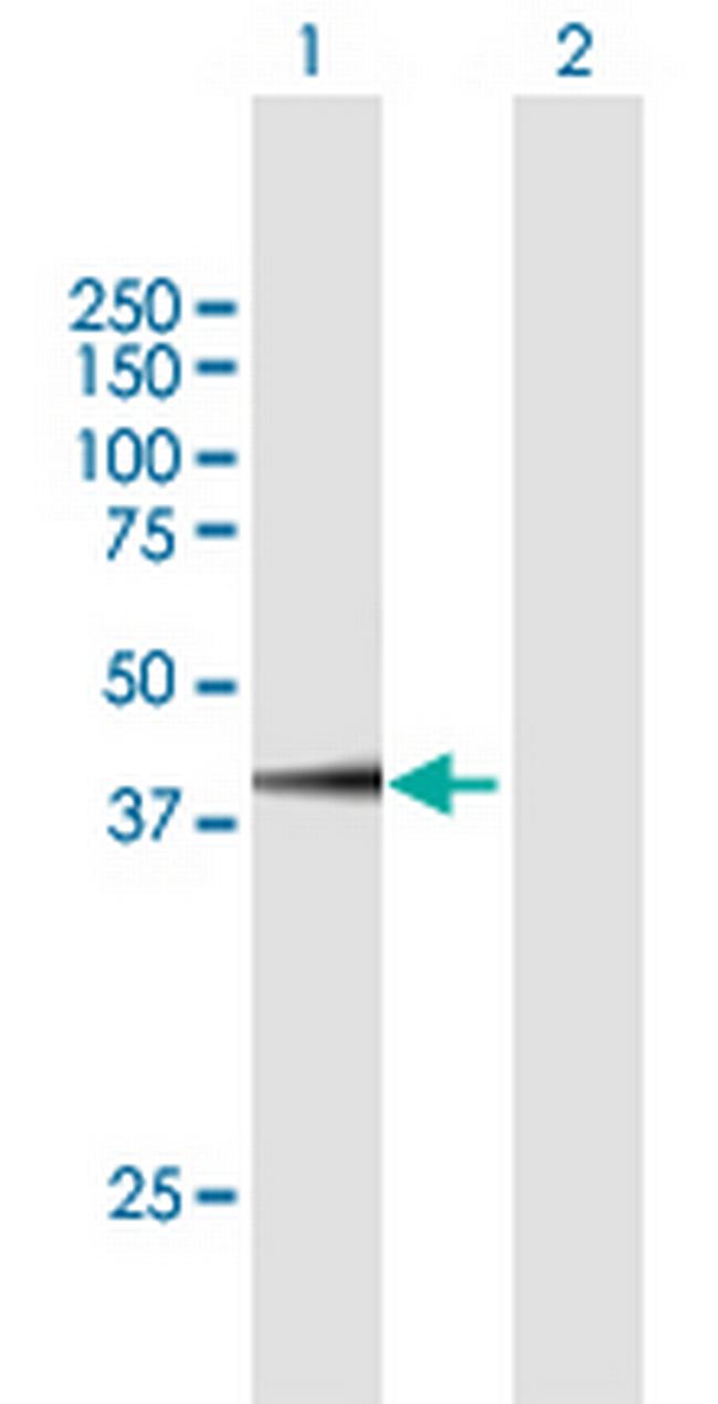 FAM46C Antibody in Western Blot (WB)