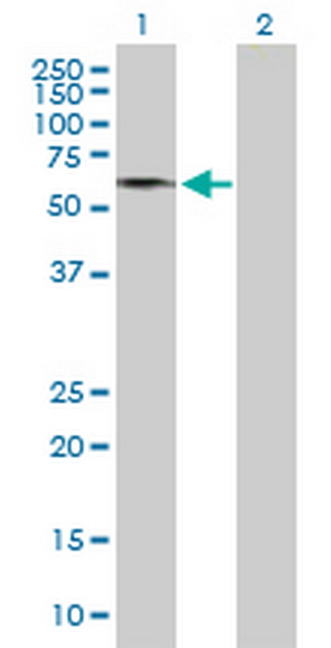 GDPD2 Antibody in Western Blot (WB)