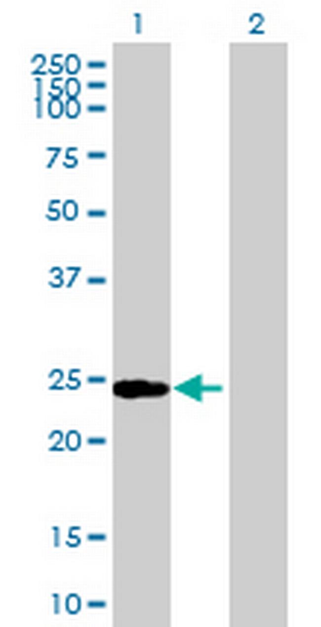 PGPEP1 Antibody in Western Blot (WB)