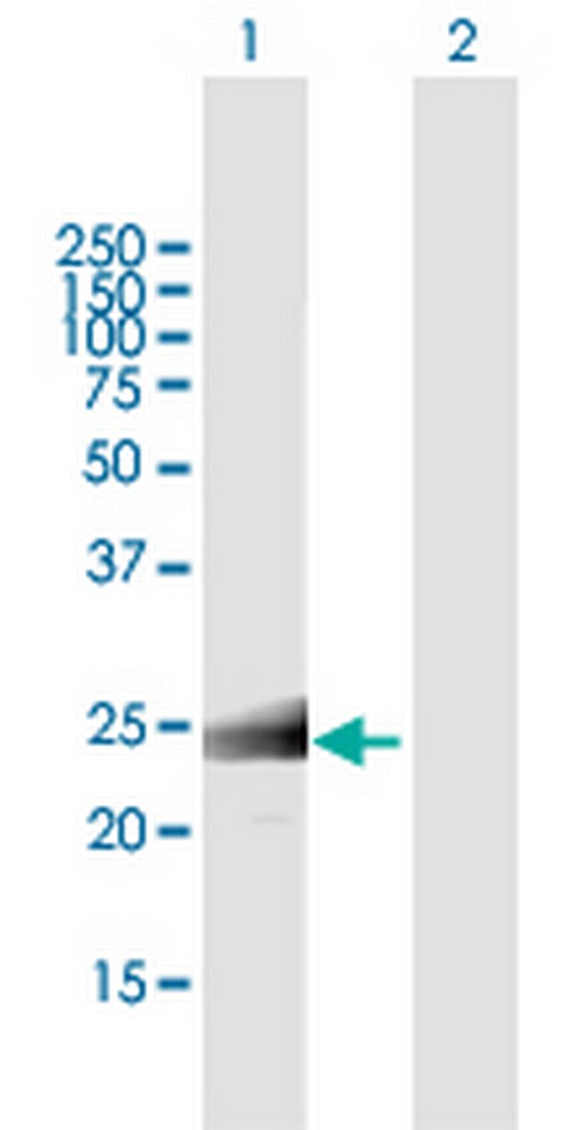 MS4A12 Antibody in Western Blot (WB)