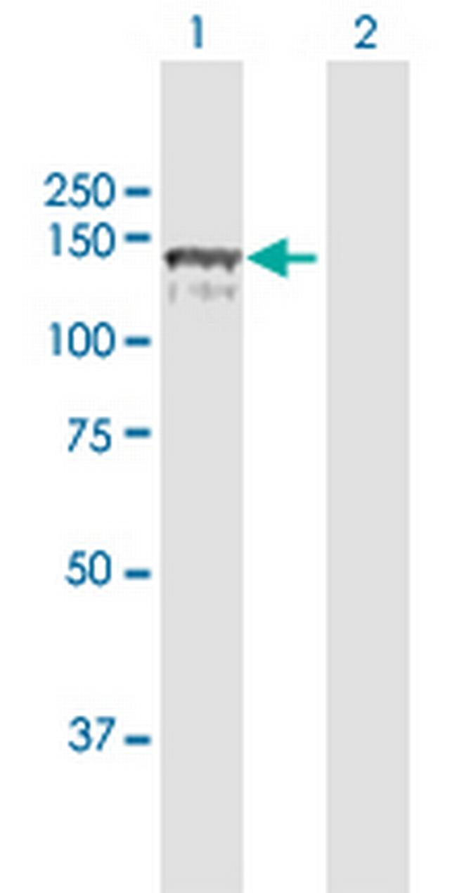 CC2D1A Antibody in Western Blot (WB)