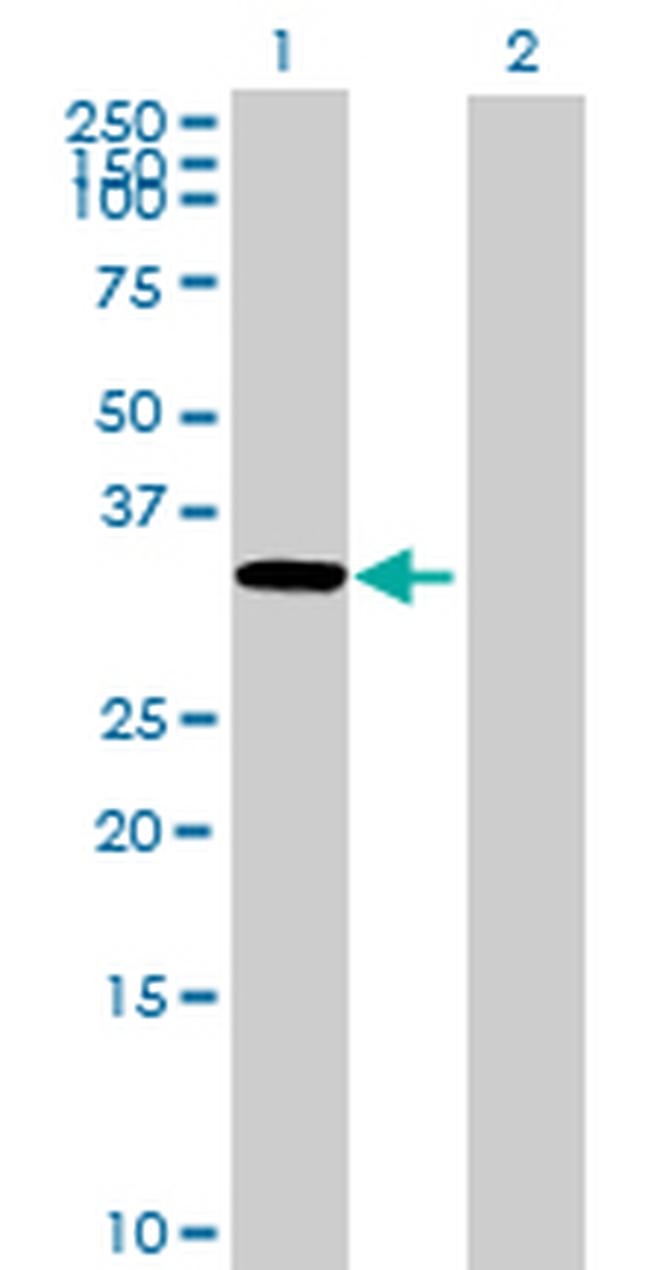 RP11-35N6.1 Antibody in Western Blot (WB)