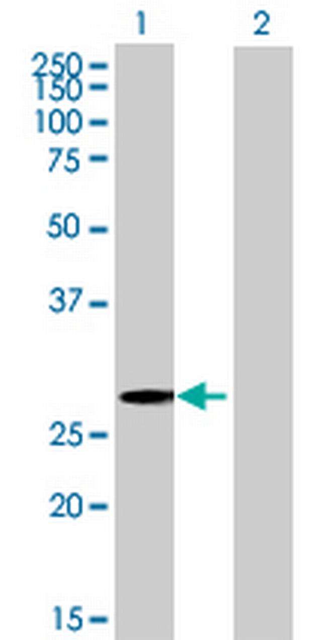 ZNF434 Antibody in Western Blot (WB)