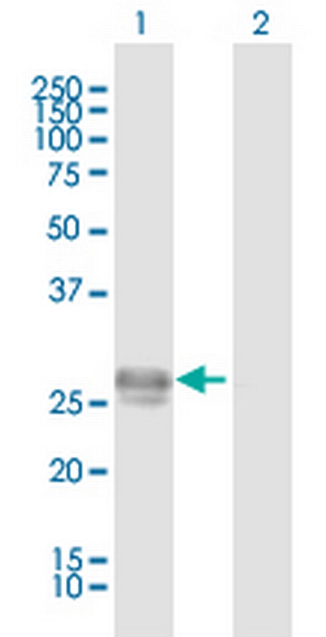CHCHD3 Antibody in Western Blot (WB)