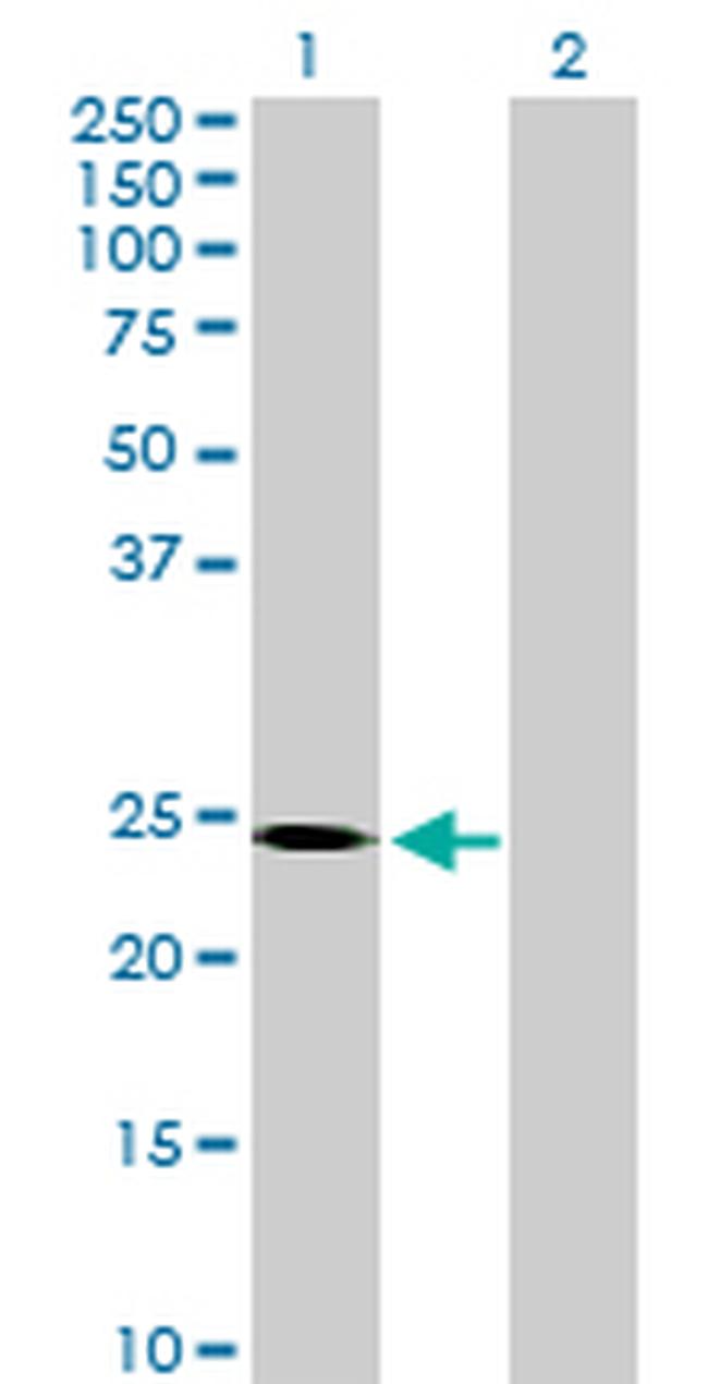 TEB1 Antibody in Western Blot (WB)