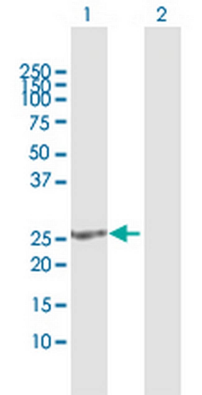 SOHLH2 Antibody in Western Blot (WB)