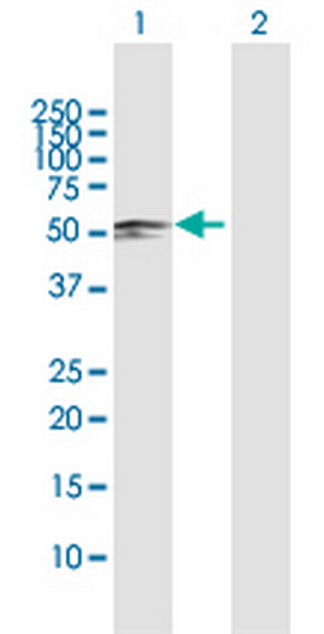 SARS2 Antibody in Western Blot (WB)