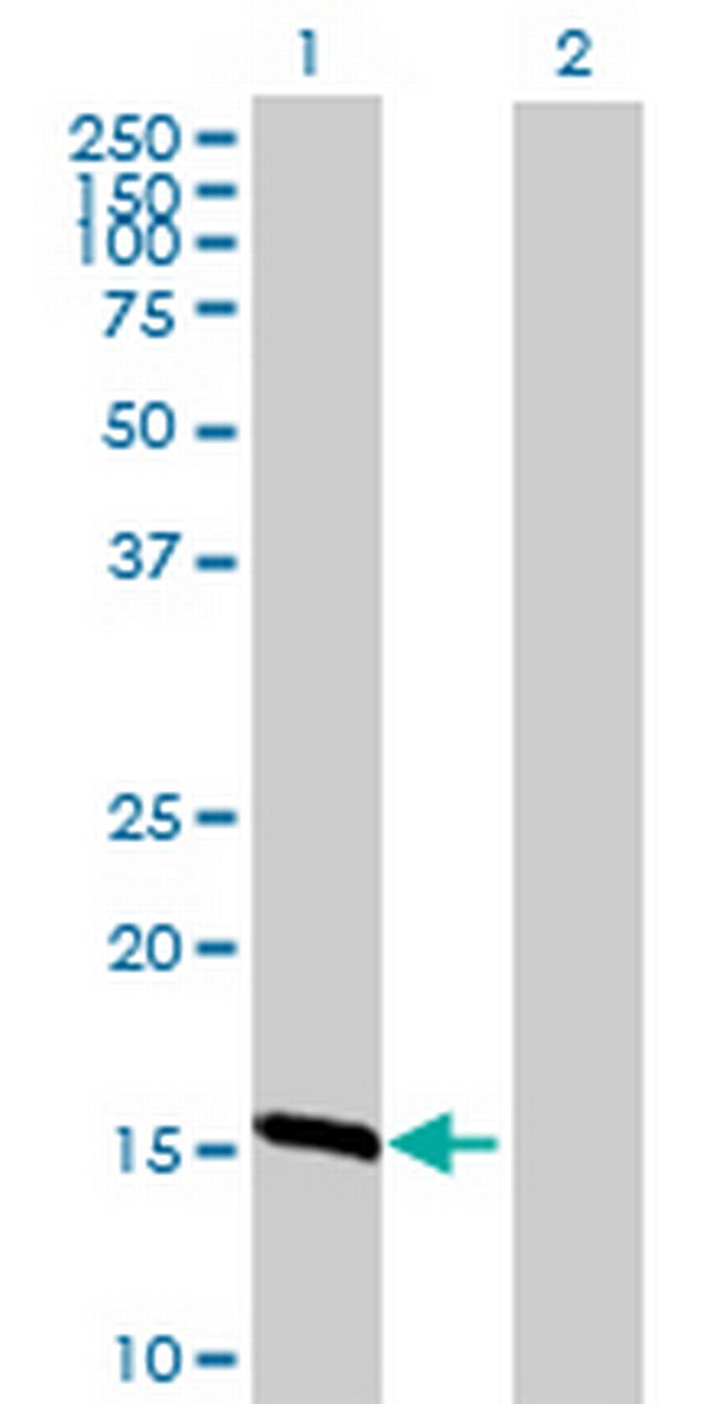 TXNL4B Antibody in Western Blot (WB)