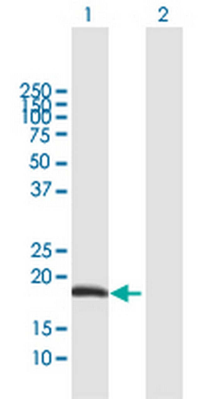 ODAM Antibody in Western Blot (WB)