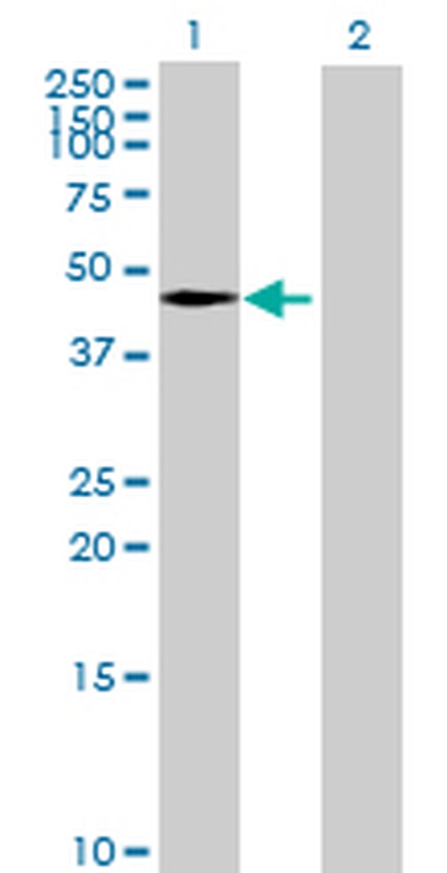 TIPIN Antibody in Western Blot (WB)