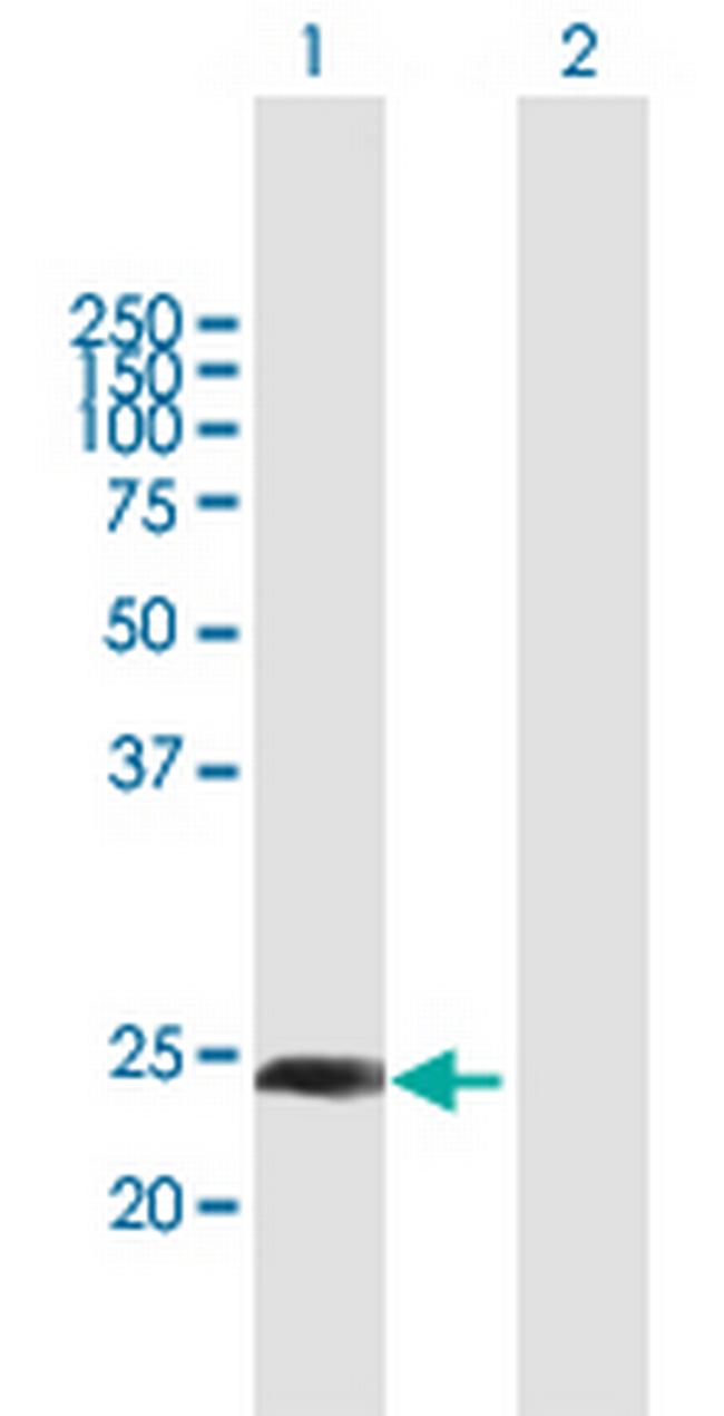 CXorf48 Antibody in Western Blot (WB)