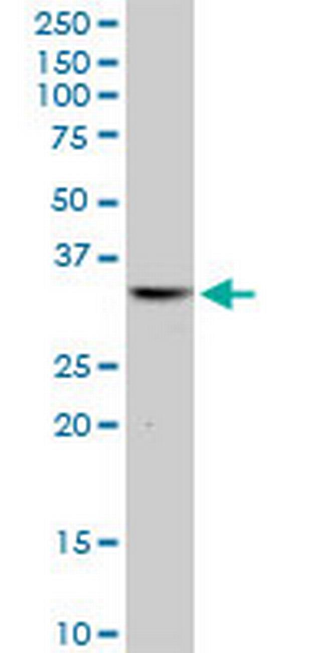 ICF45 Antibody in Western Blot (WB)