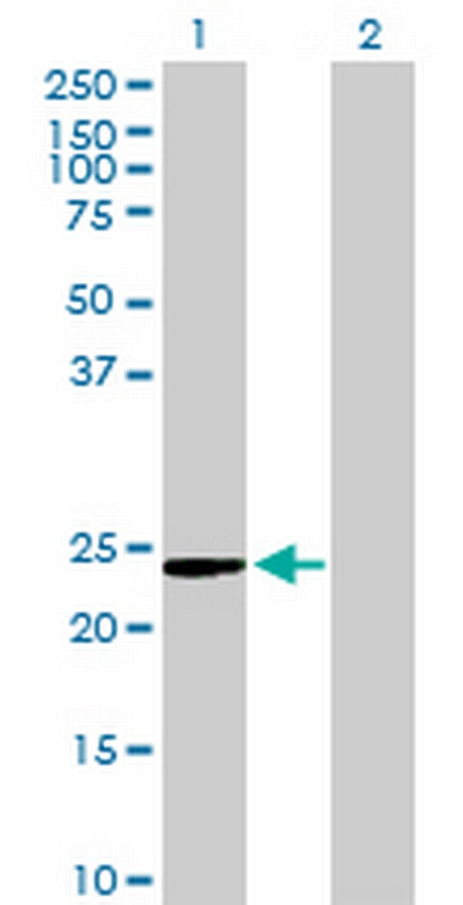 C9orf95 Antibody in Western Blot (WB)