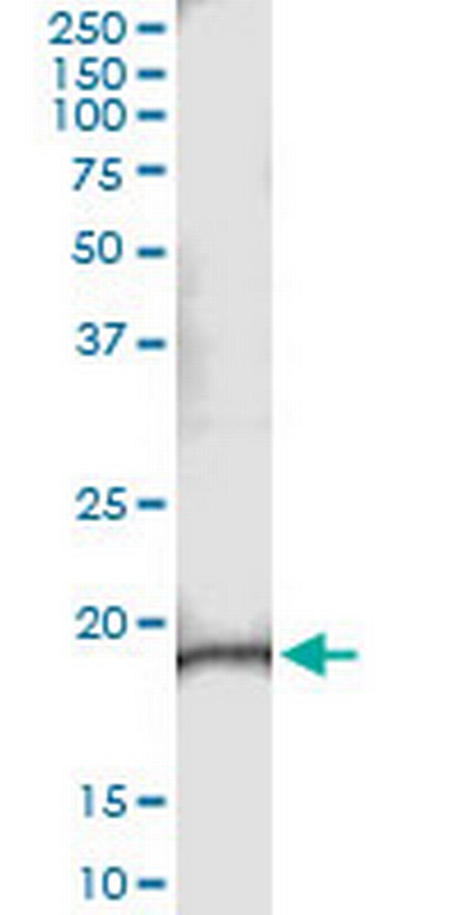 C9orf95 Antibody in Immunoprecipitation (IP)