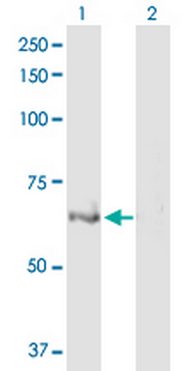 ULK4 Antibody in Western Blot (WB)