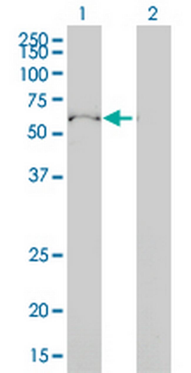 ULK4 Antibody in Western Blot (WB)
