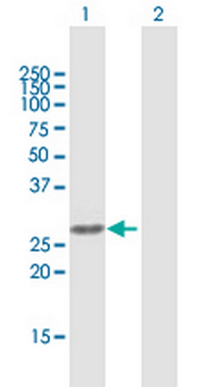 AURKAIP1 Antibody in Western Blot (WB)