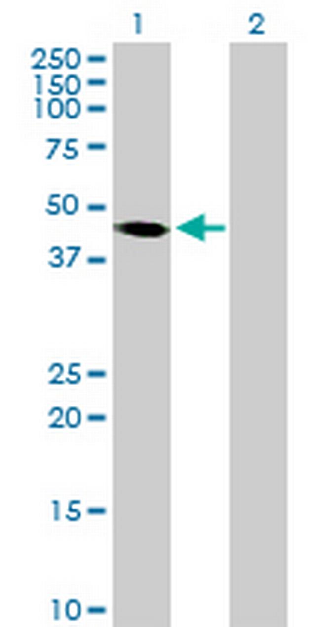 PAK1IP1 Antibody in Western Blot (WB)