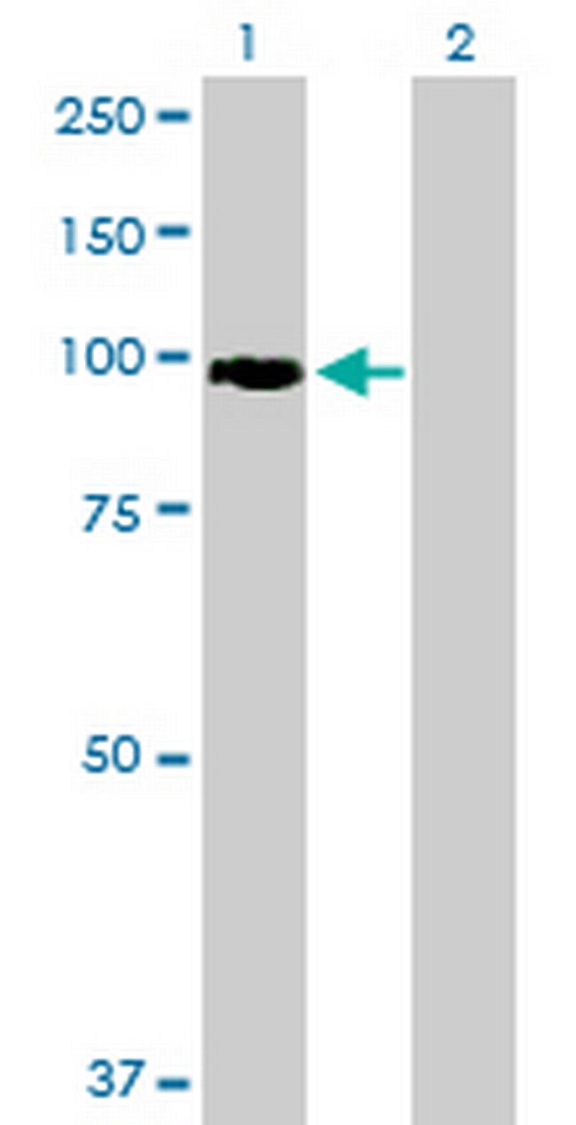 FBXO34 Antibody in Western Blot (WB)