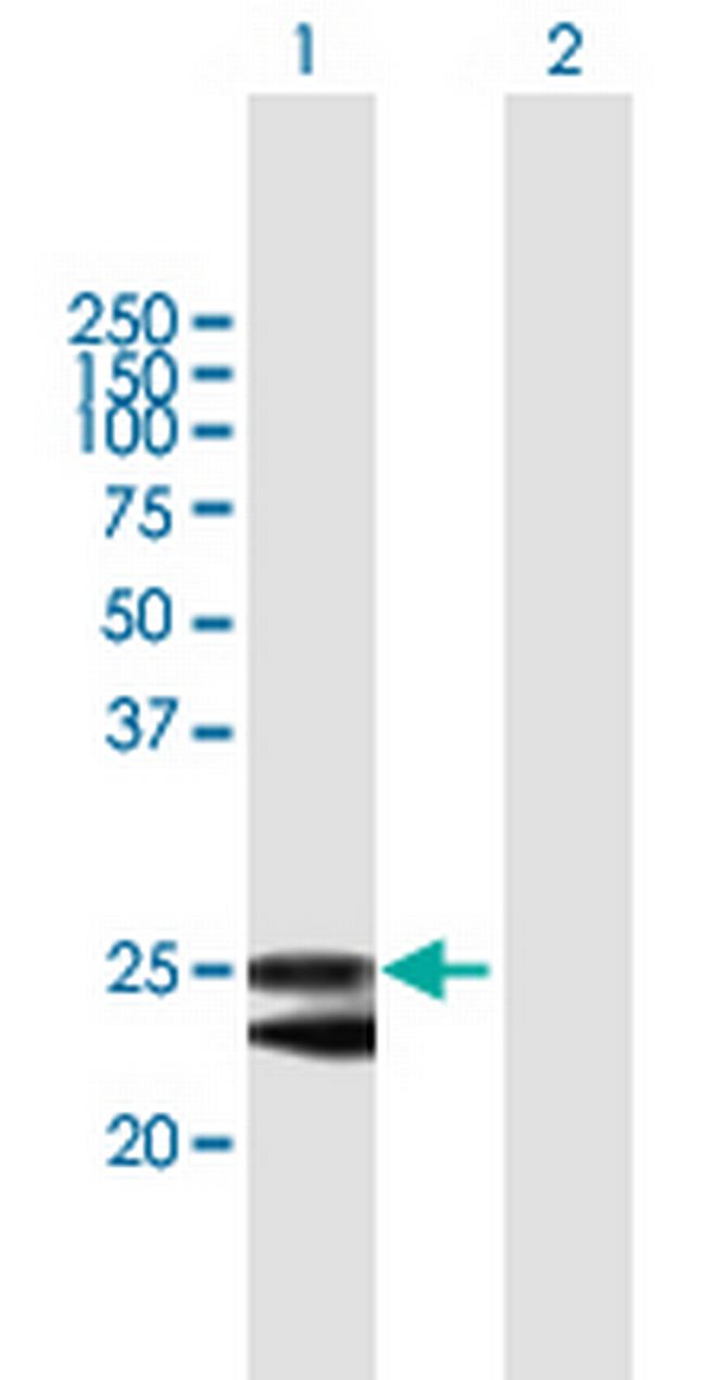 FKBP14 Antibody in Western Blot (WB)