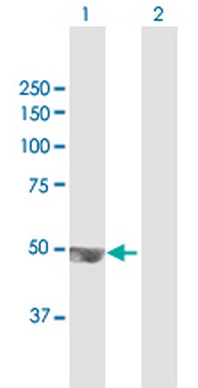 TRMT12 Antibody in Western Blot (WB)