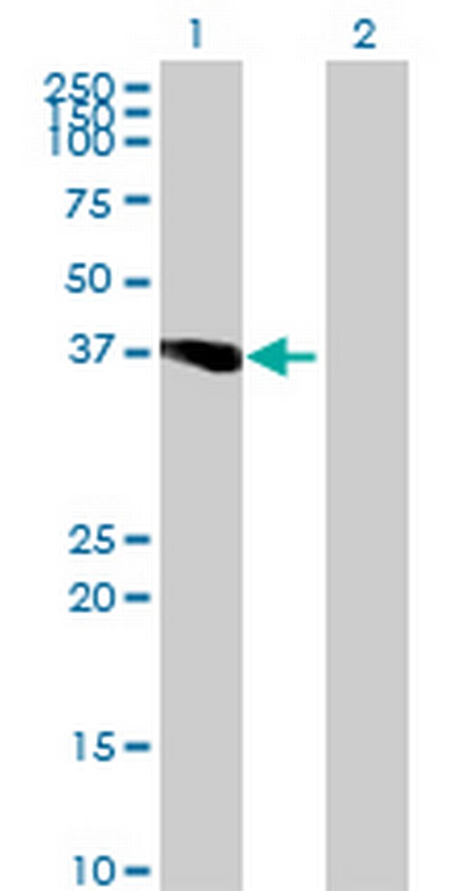 PLEKHB2 Antibody in Western Blot (WB)